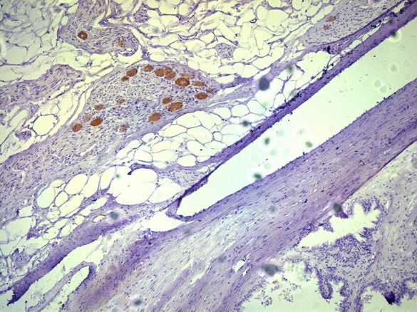 Парасимпатические нервные волокна в парапростатической ткани Окраска ИГХ Nitric oxide